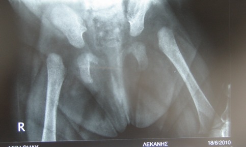 Υπερηχογράφημα βρεφικού ισχίου