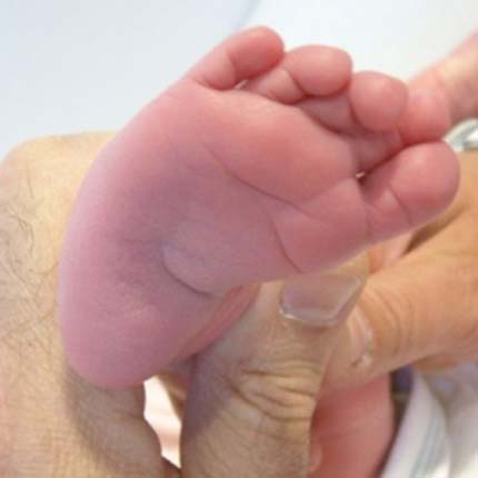 Ραιβοιπποποδία