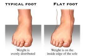 Εγκεφαλική παράλυση